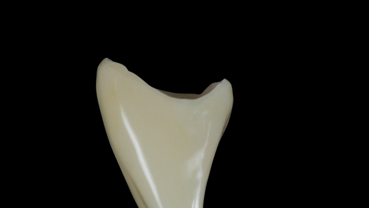 Afterwork : Comprendre la zircone pour éviter les échecs