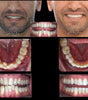 BIOMÉCANIQUE : Maîtriser les clés de l'excellence en orthodontie