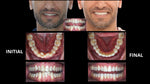 BIOMÉCANIQUE : Maîtriser les clés de l'excellence en orthodontie