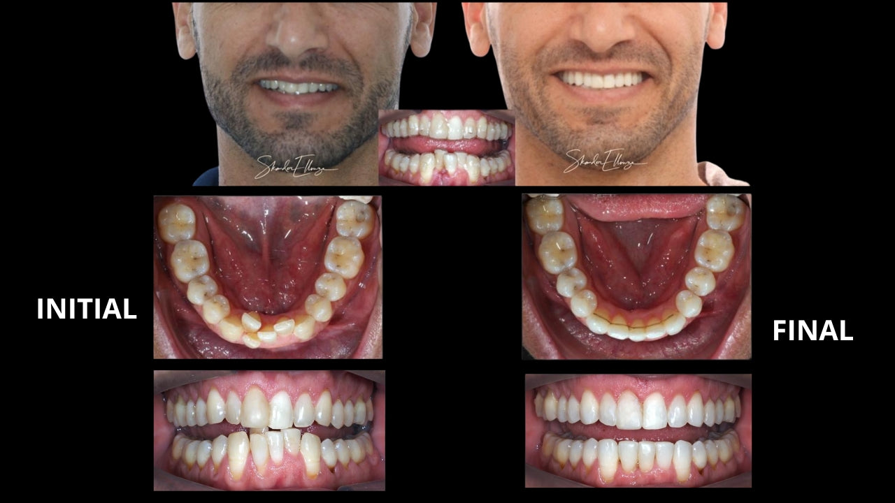 BIOMÉCANIQUE : Maîtriser les clés de l'excellence en orthodontie