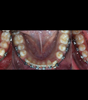 BIOMÉCANIQUE : Maîtriser les clés de l'excellence en orthodontie