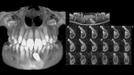 BIOMÉCANIQUE : Maîtriser les clés de l'excellence en orthodontie