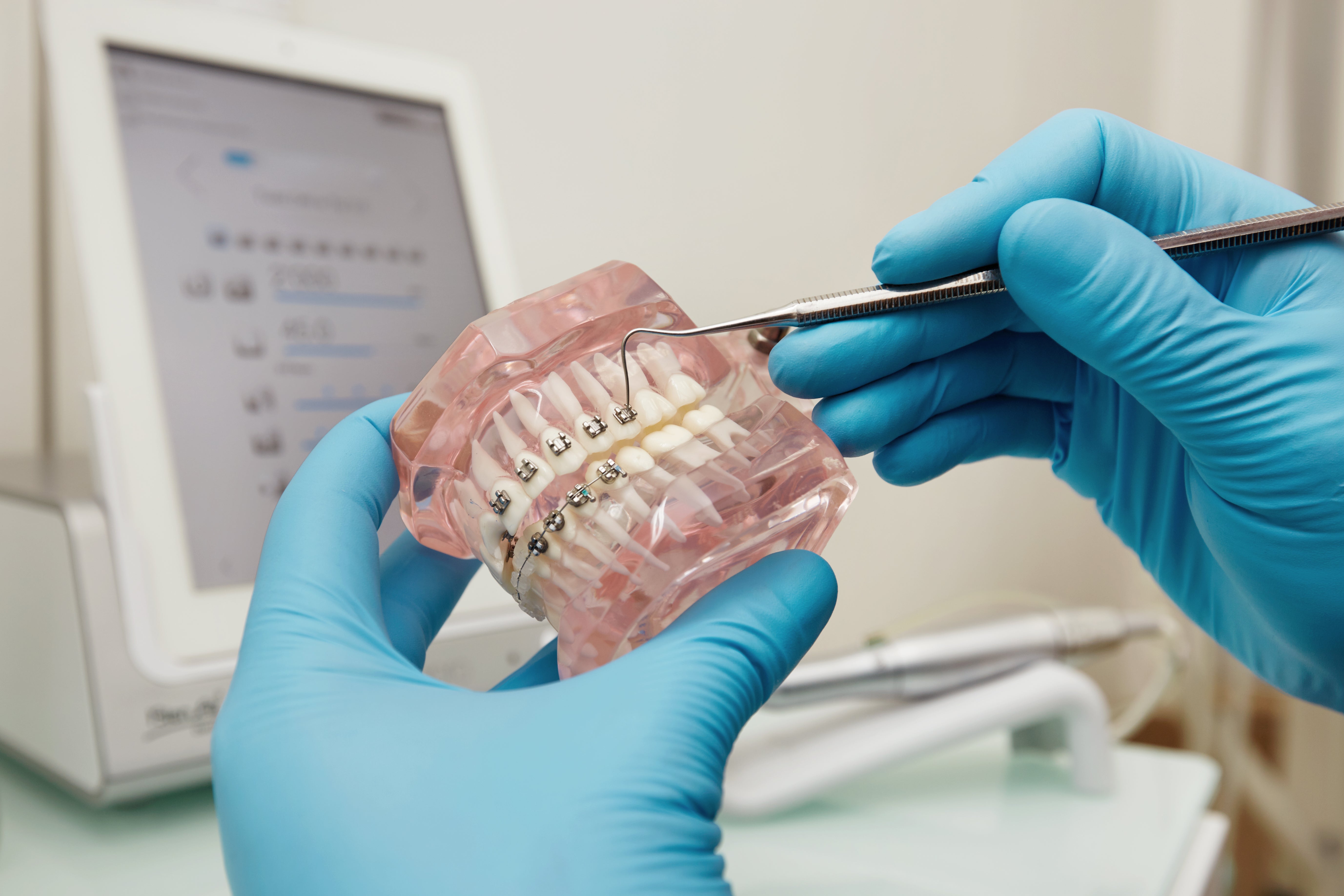 Formation orthodontie chirurgien-dentiste certifiée Qualiopi | Capsule