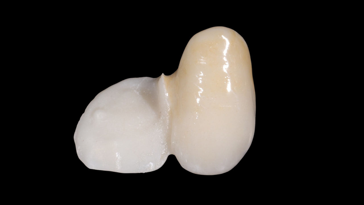 Afterwork : Comprendre la zircone pour éviter les échecs
