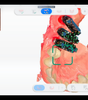 IMPLANTOLOGIE CLINIQUE GUIDEE