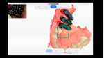 IMPLANTOLOGIE CLINIQUE GUIDEE