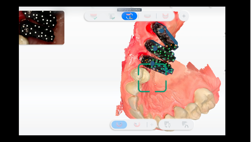 GUIDED CLINICAL IMPLANTOLOGY