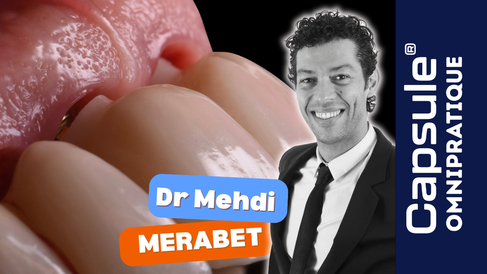 Le challenge esthétique et stratégie implantaire : une approche multidisciplinaire