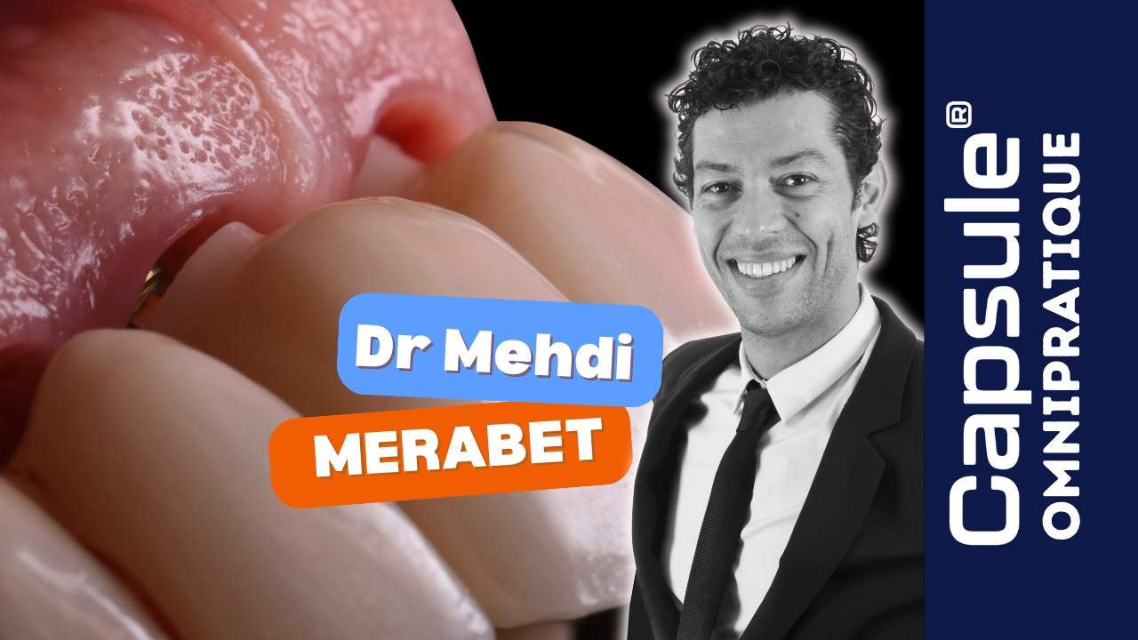Dr Merabet, implantologue, formation challenge esthétique et stratégie implantaire multidisciplinaire Capsule.