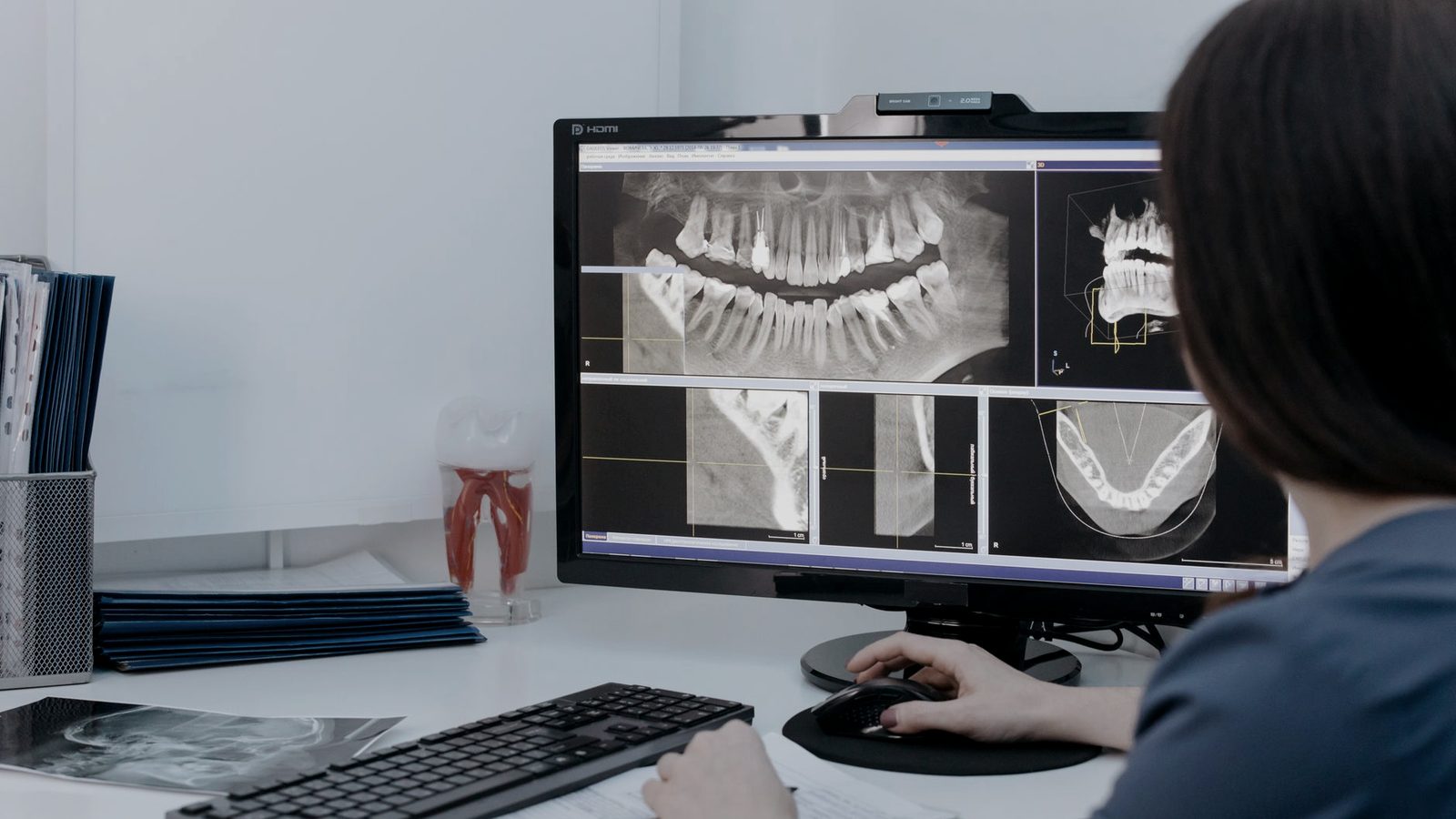 Une praticienne examine une radiographie panoramique sur l&rsquo;écran de son poste de travail