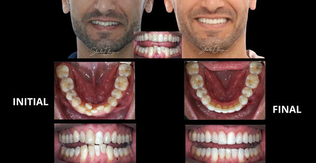 BIOMÉCANIQUE : Maîtriser les clés de l'excellence en orthodontie