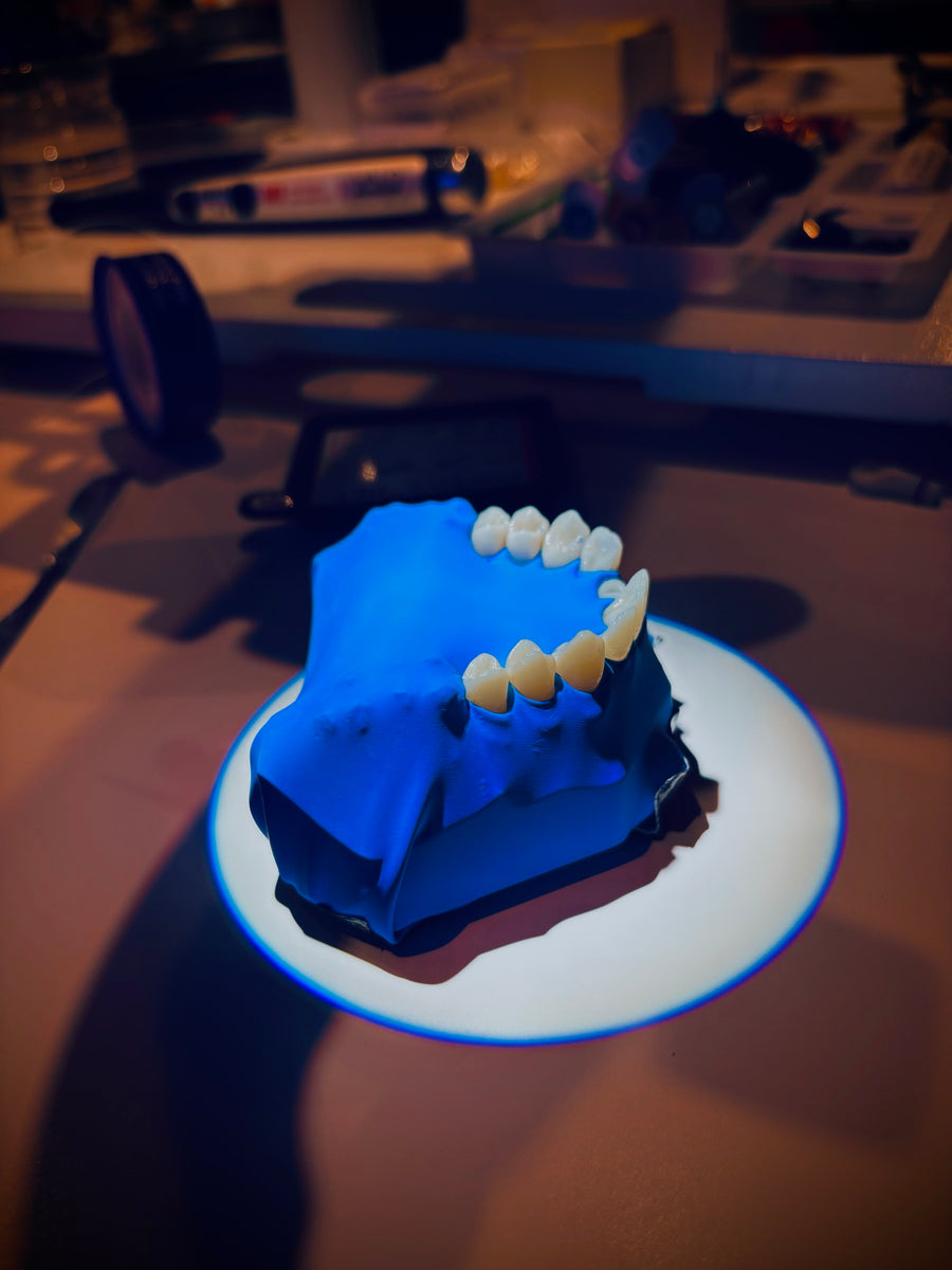 Clé en silicone posée sur un modèle de travail avant préparation verticale